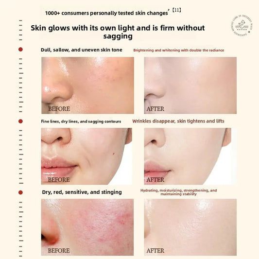 Astaxanthin face care lotion set for brightening and hydrating skin
