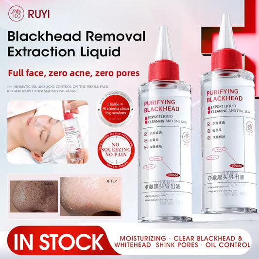Blackhead removal liquid bottle for pore refining