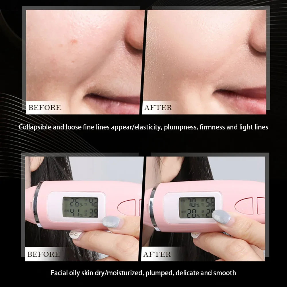 MERCILEN Conopeptide Anti-Gravity Lifting Face Cream — Conopeptide — Product with outer packaging box set