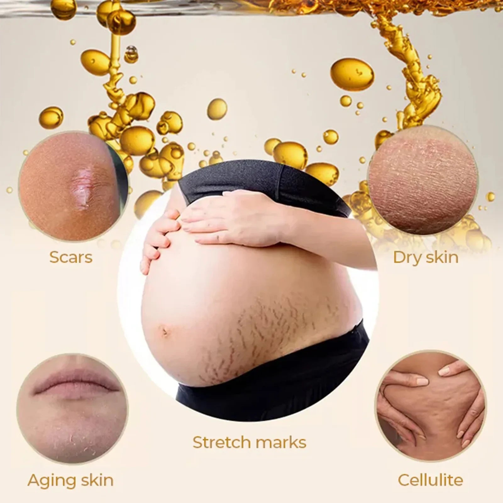 Bottle of stretch mark removal oil with olive essential oil for postpartum skin care