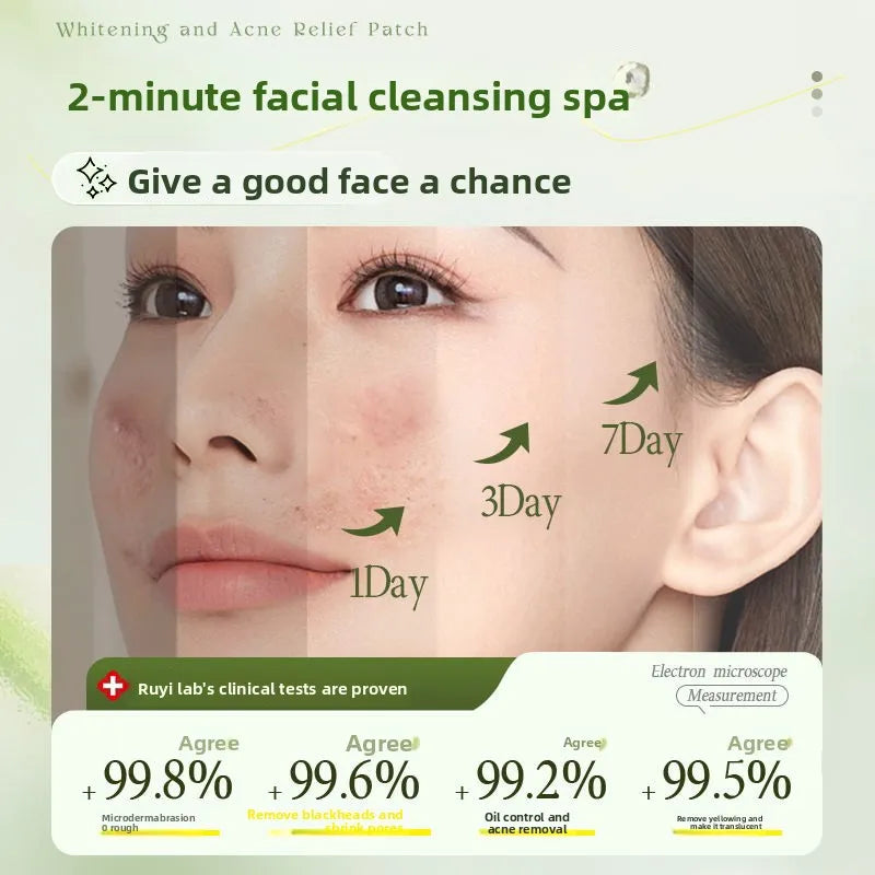 RUYI Aloe Vera Fruit Acid Exfoliating Gel for Face-dead Skin Removal Pore Cleansing Blackhead Treatment Skin Smoothing