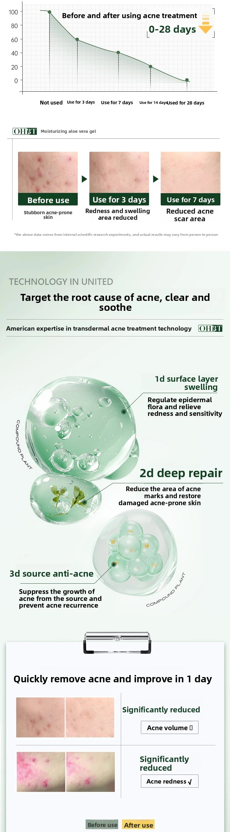 OHBT 300g  Aloe Vera Gel Creams Moisturizing Brightening Nourishing Firming Hydrating Face Cream Facial Skin Care Products