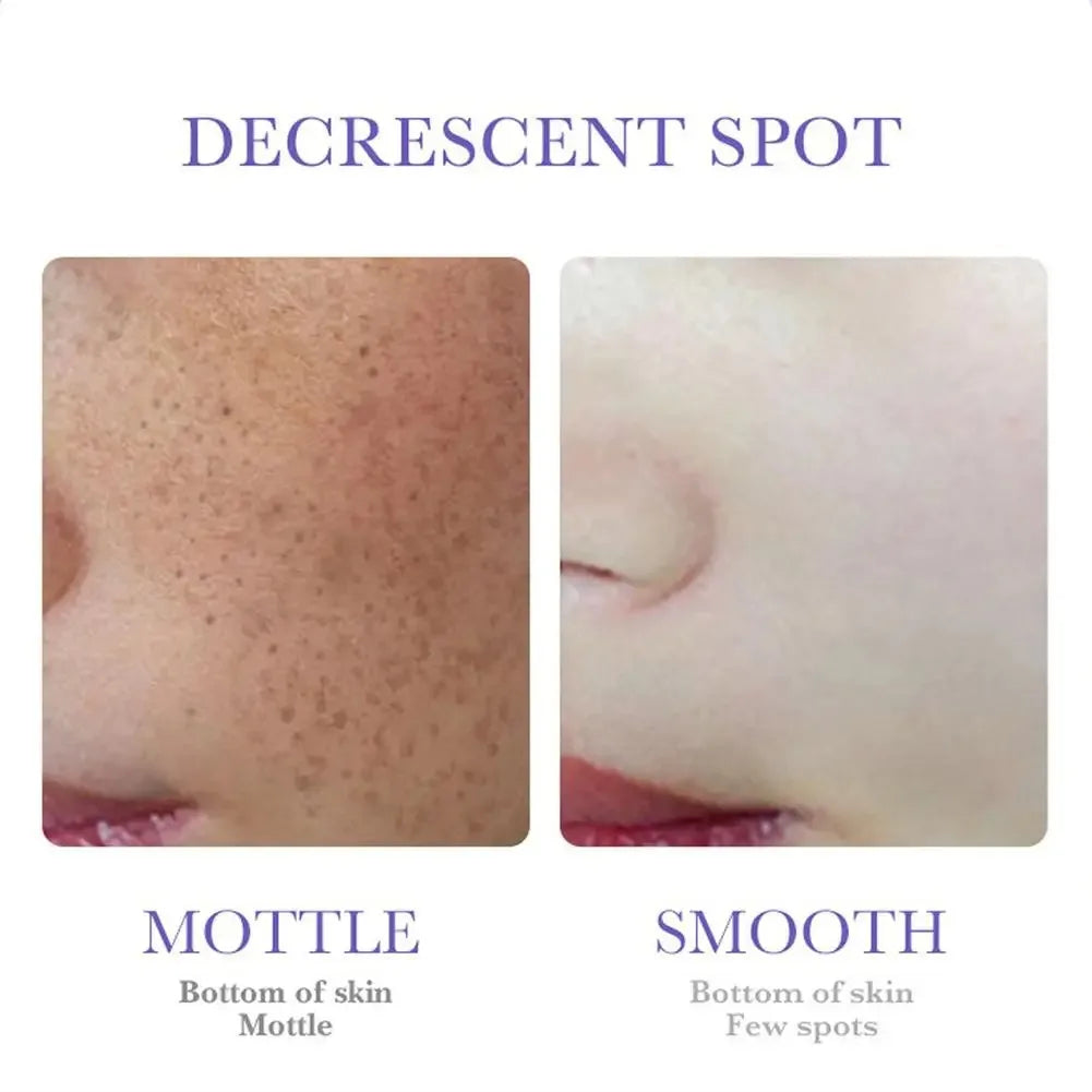 Niacinamide dark spot corrector cream for fading freckles and brightening skin