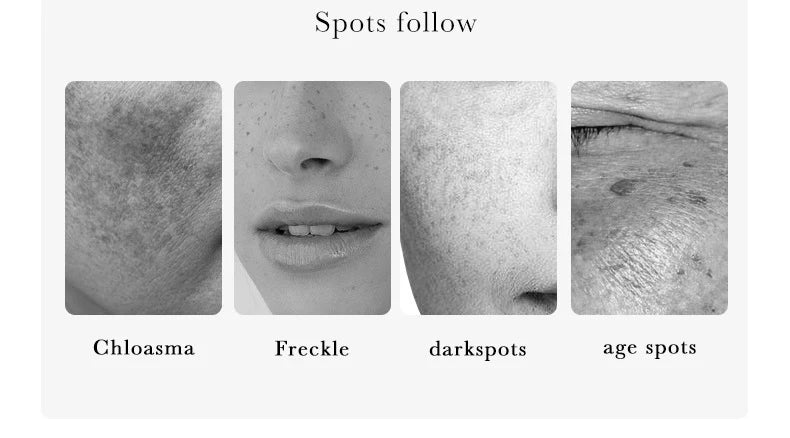 Nicotinamide dark spot correcting essence set with serum bottles and packaging