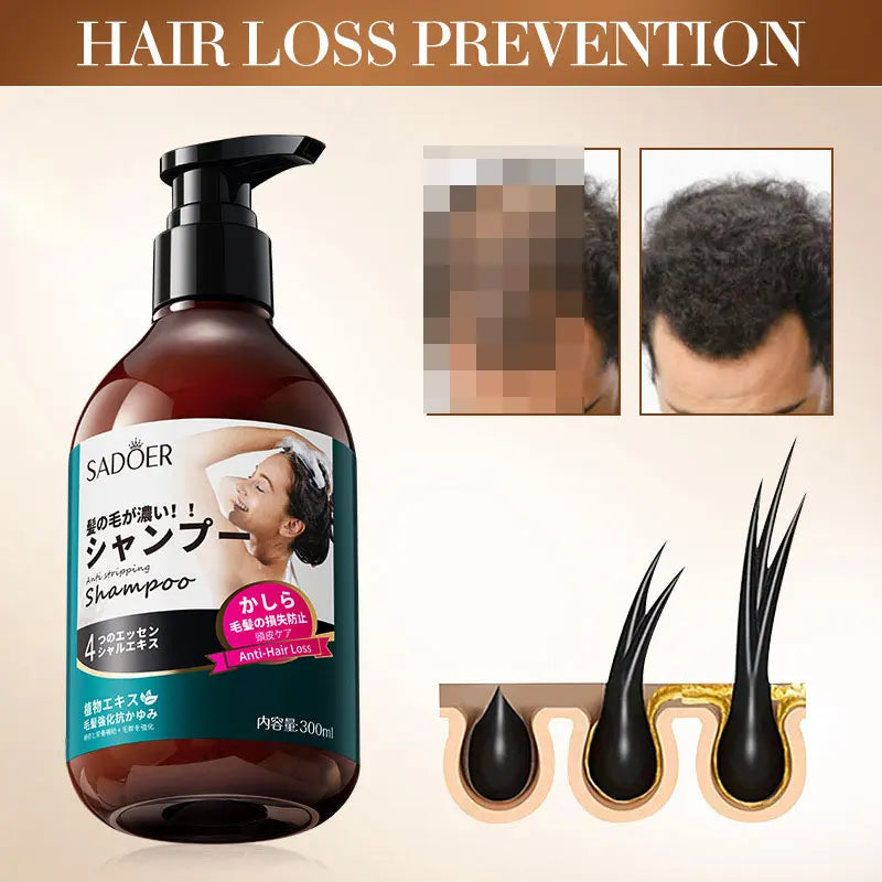 Anti-Hair Loss Shampoo Deep Cleanse Oil Control Nourishing