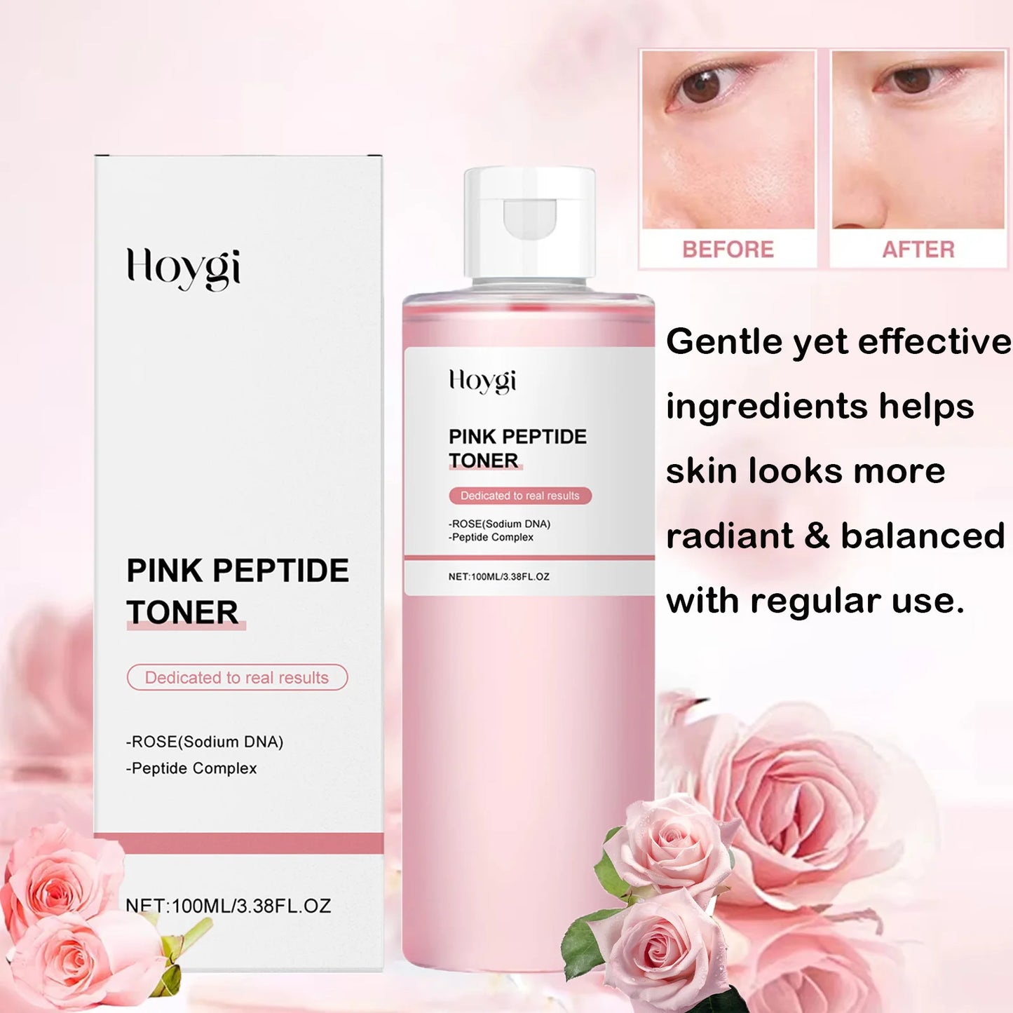 HOYGI Rose Peptide Brightening Glow Toner — rose + peptide — packaging box on white background