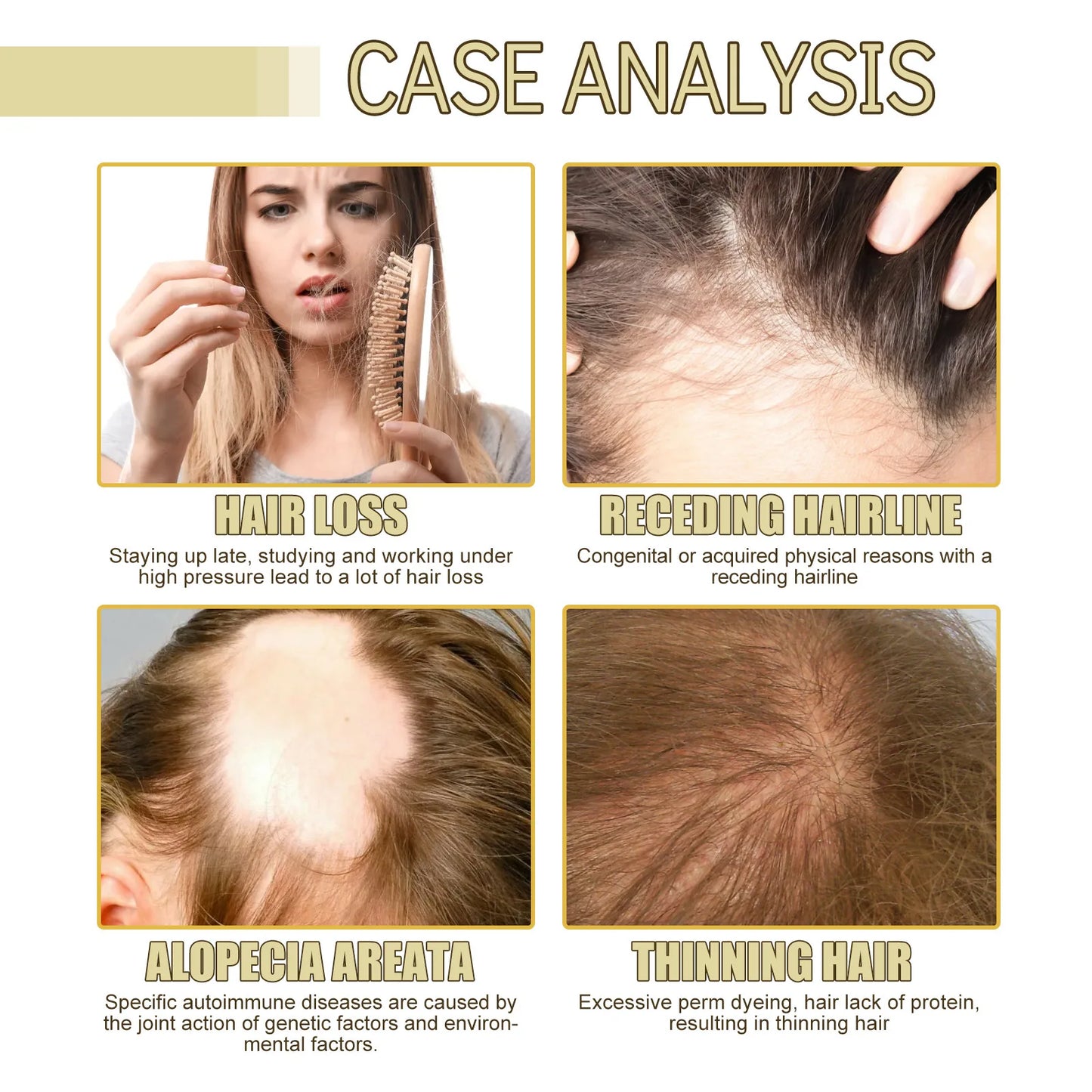 EELHOE — Rosemary Essential Oil — Before and after hair growth results