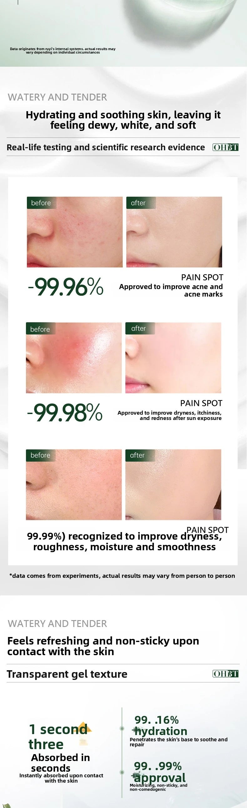 OHBT 300g  Aloe Vera Gel Creams Moisturizing Brightening Nourishing Firming Hydrating Face Cream Facial Skin Care Products