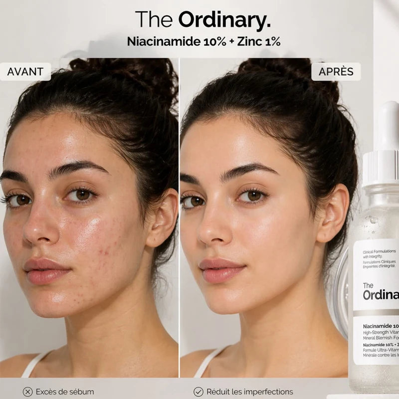 SkinSwaag Beauty The Ordinary Niacinamide 10% + Zinc 1% Serum — niacinamide + zinc — bottle back view on white background