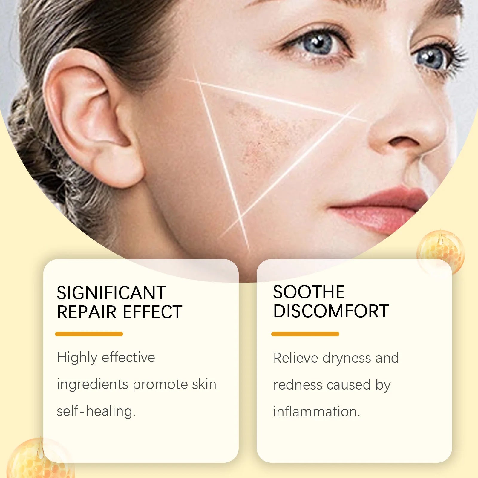 7 Days Bee Venom Skin Restorating Cream — Bee Venom & Collagen — Before and after skin blemish removal result