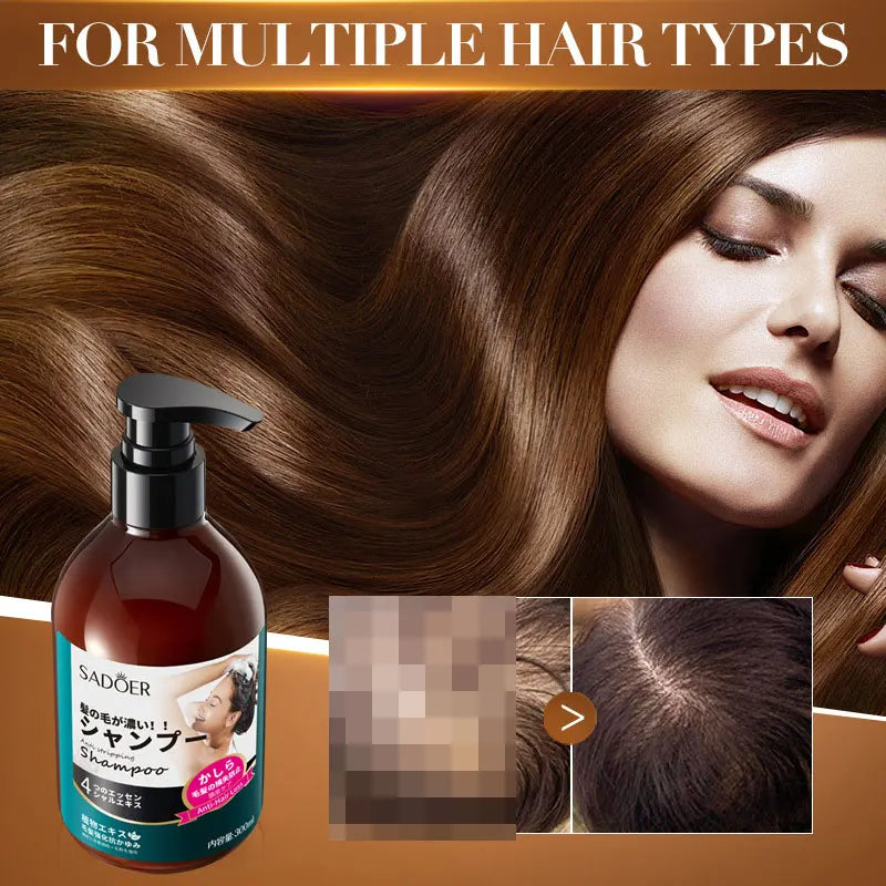 Anti-Hair Loss Shampoo Deep Cleanse Oil Control Nourishing