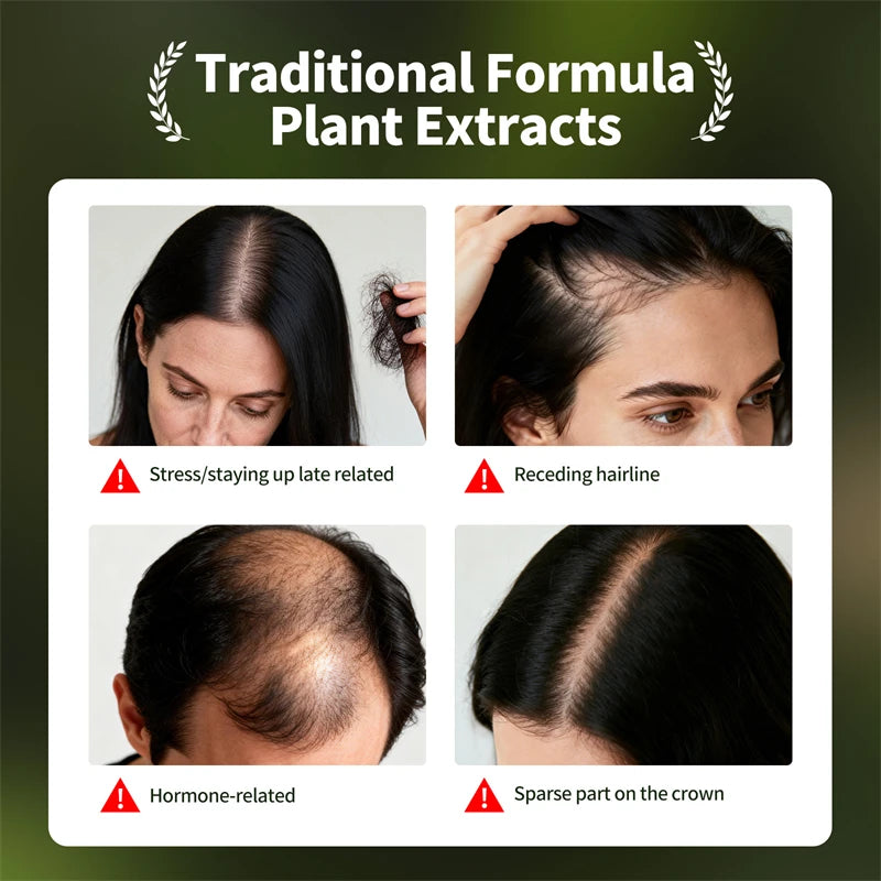 Anti hair loss serum set with hair growth essential oil, shampoo soap, and thickening oil spray for men and women.