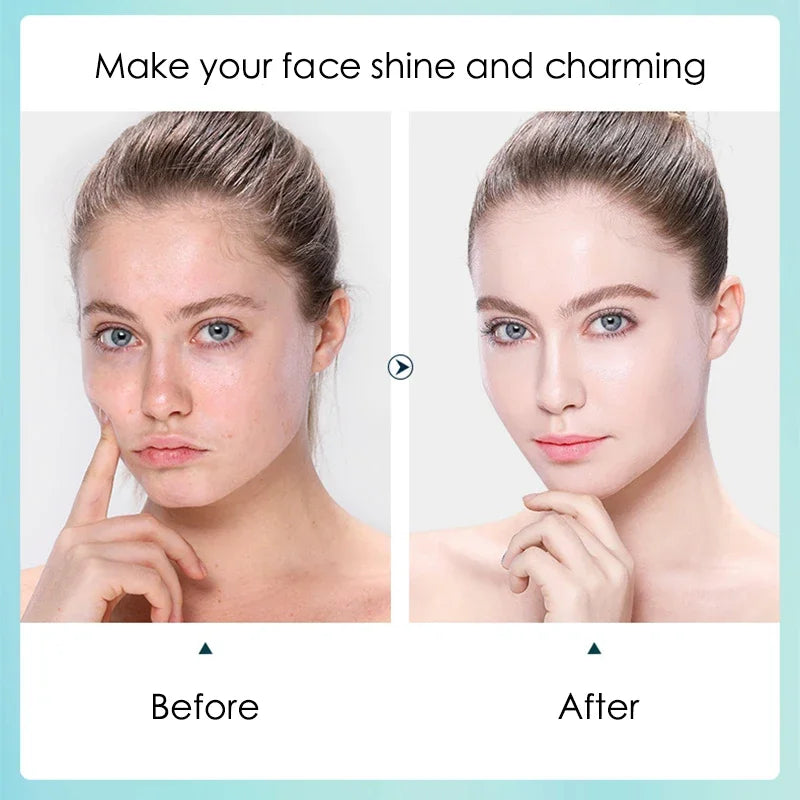 Five white sheet masks with hyaluronic acid pore-shrinking formula