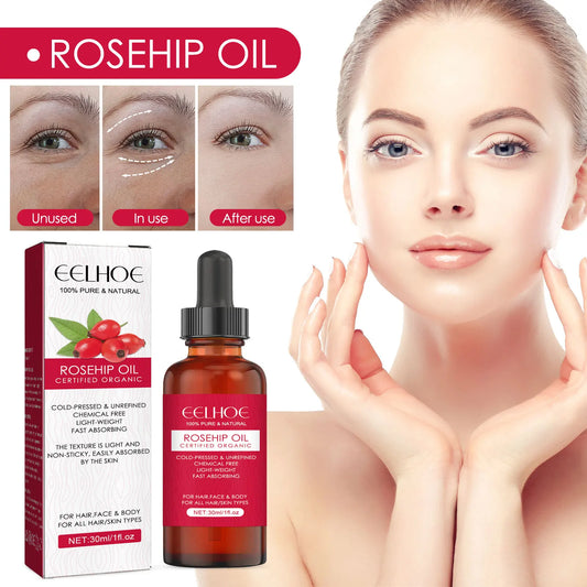 EELHOE — Rosehip Oil Face & Hair Serum 30ml — Gold dropper bottle on white background