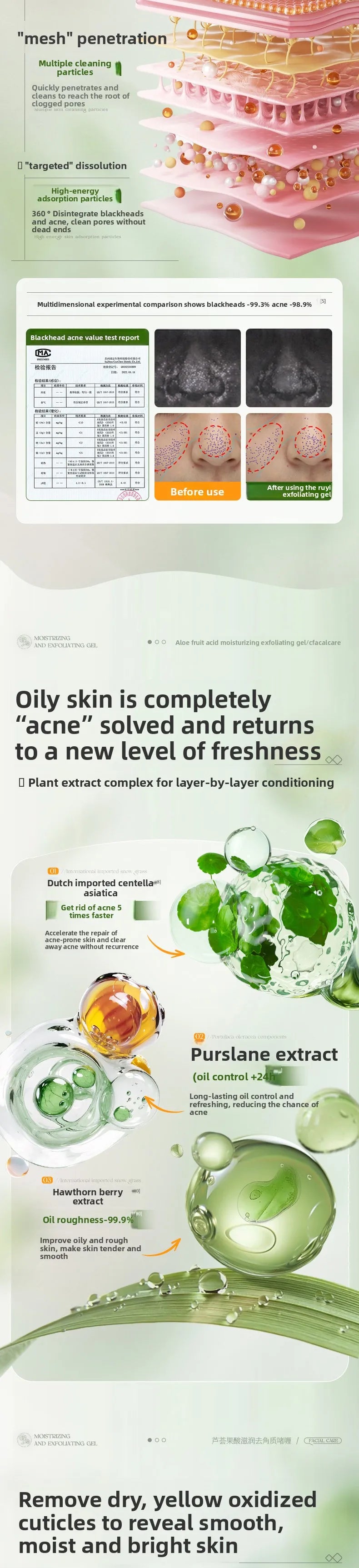 RUYI Aloe Vera Fruit Acid Exfoliating Gel for Face-dead Skin Removal Pore Cleansing Blackhead Treatment Skin Smoothing