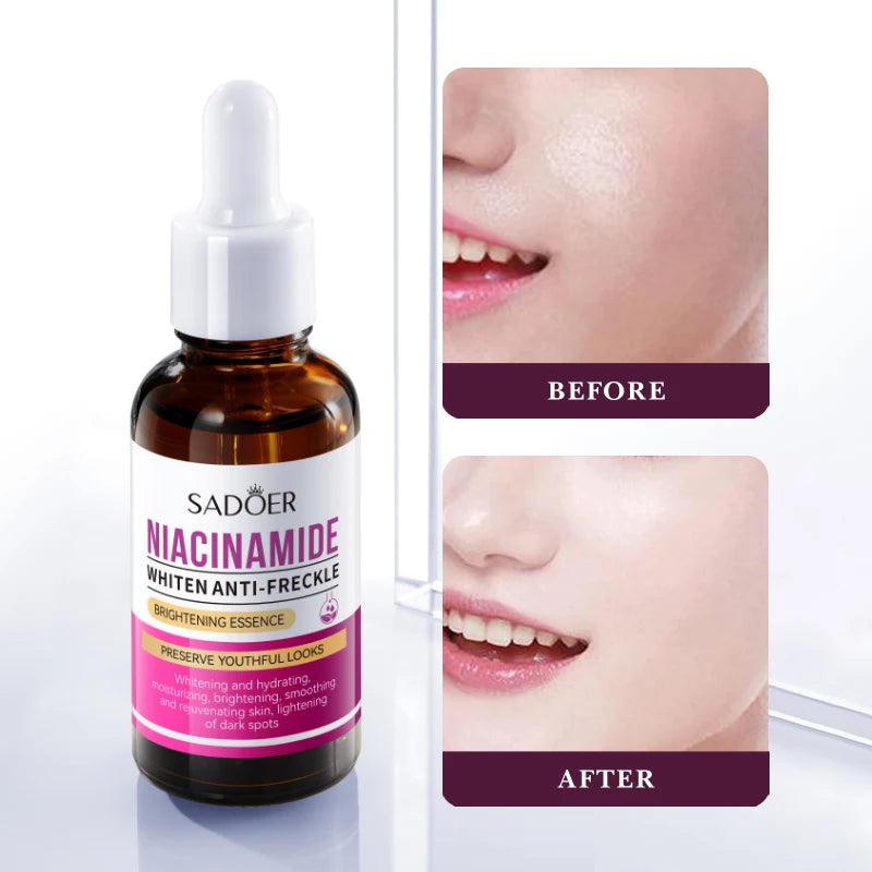 Skincare essence bottle for brightening skin and reducing the appearance of freckles