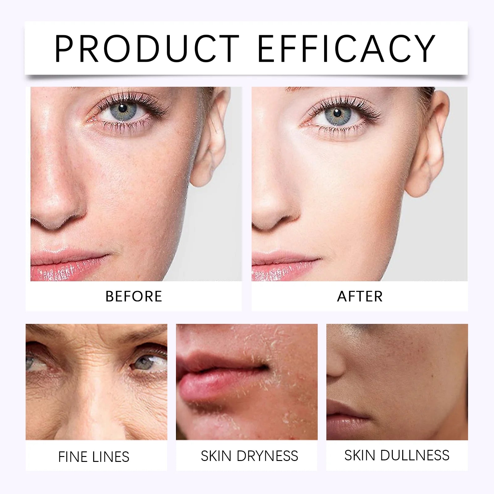HOYGI — Fading Spot Body Lotion — Before and after dark spot fading results
