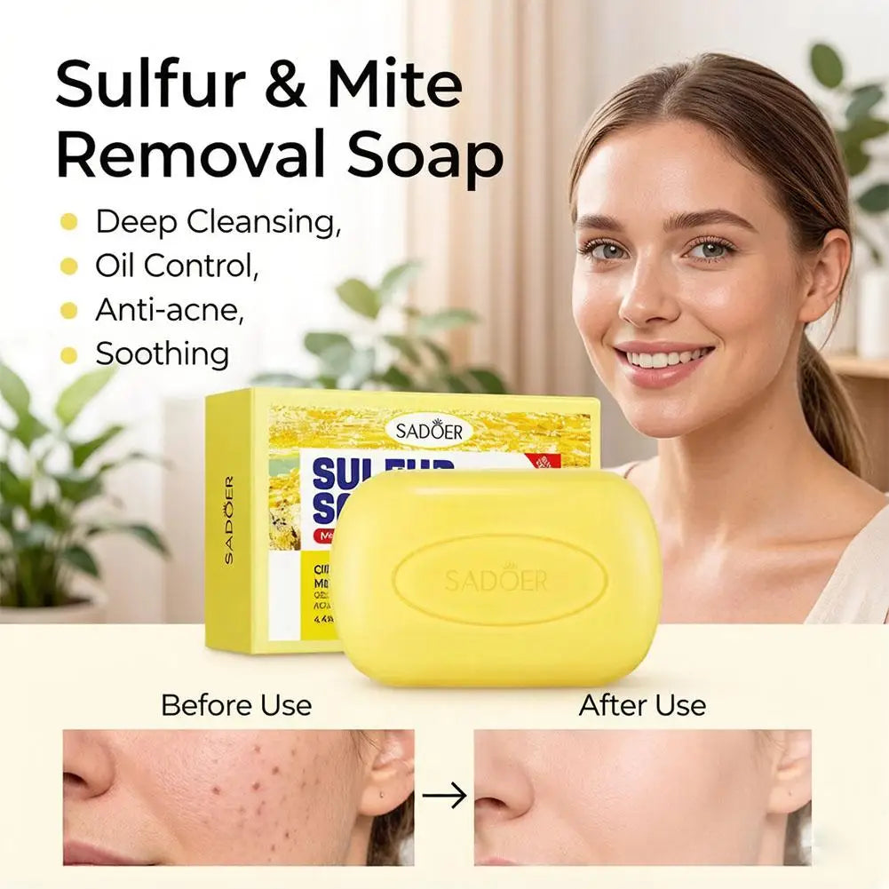 Sulfur soap bar for cleansing, moisturizing, and mite-removing skincare