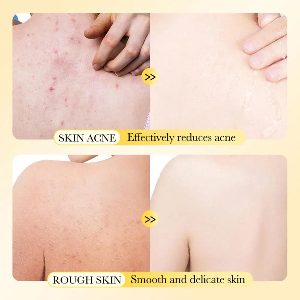 Bar of sulfur soap for mite removal and moisturizing cleansing