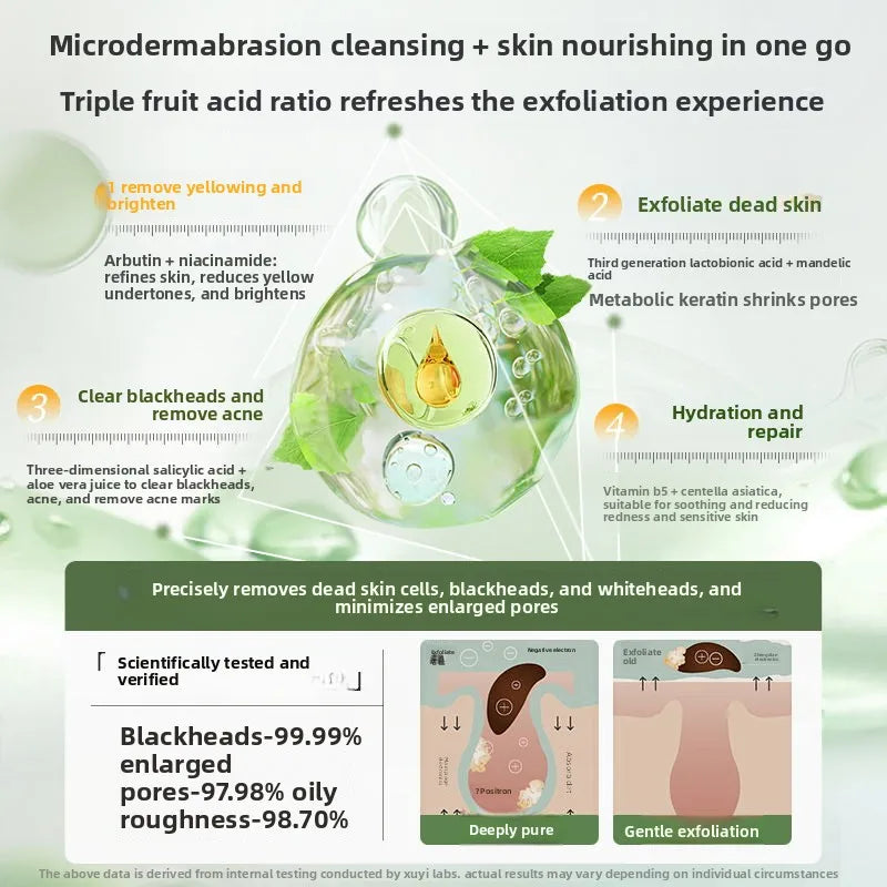 RUYI Aloe Vera Fruit Acid Exfoliating Gel for Face-dead Skin Removal Pore Cleansing Blackhead Treatment Skin Smoothing