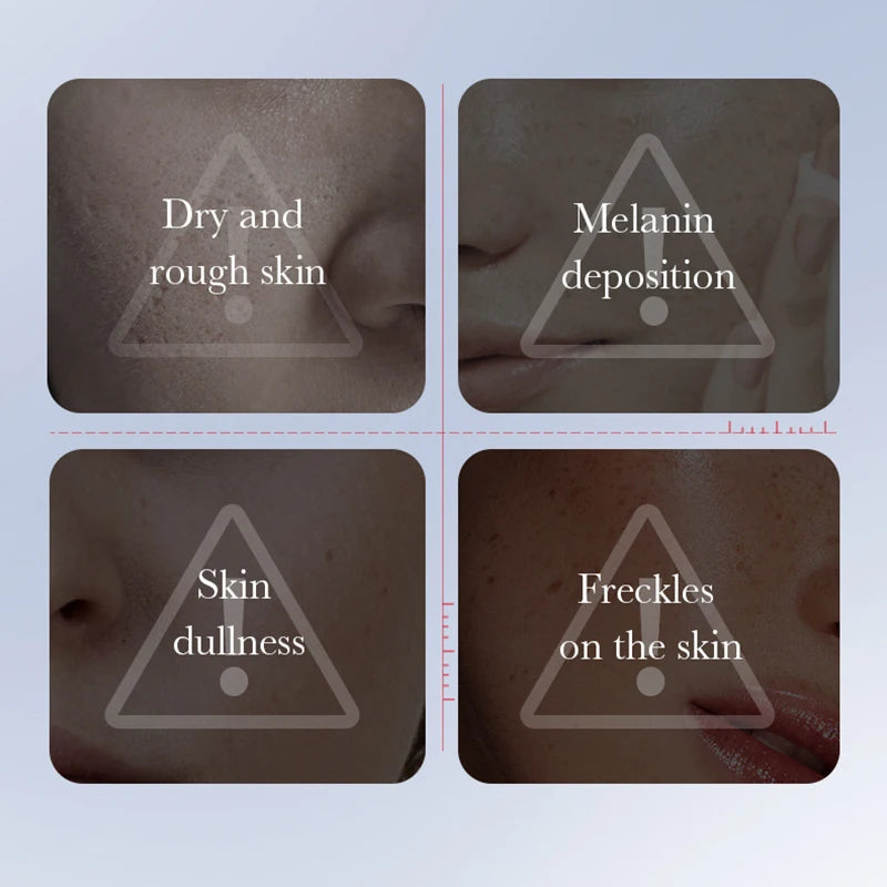Kojic acid brightening serum bottle for freckle and dark spot correction