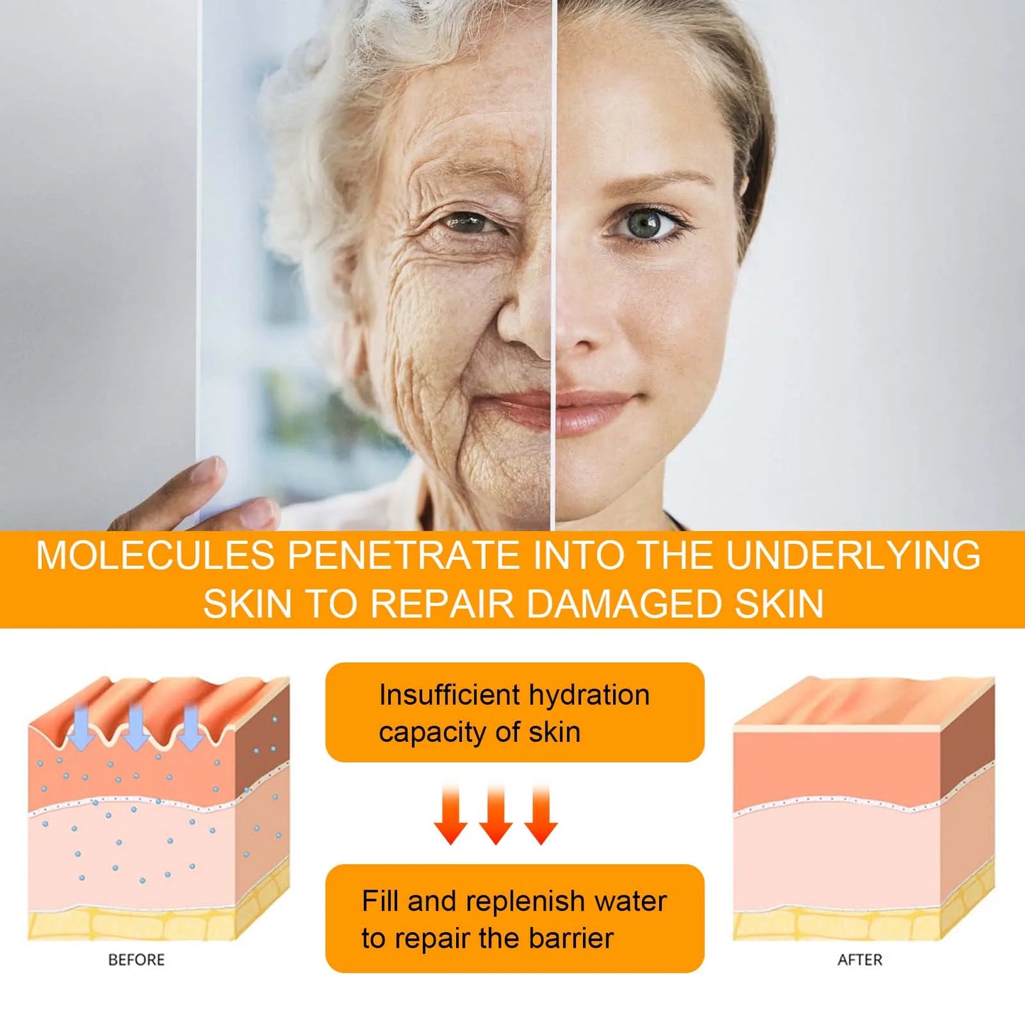 Hoygi 5D Peptide Eye Cream — 5D peptide complex — before and after eye area