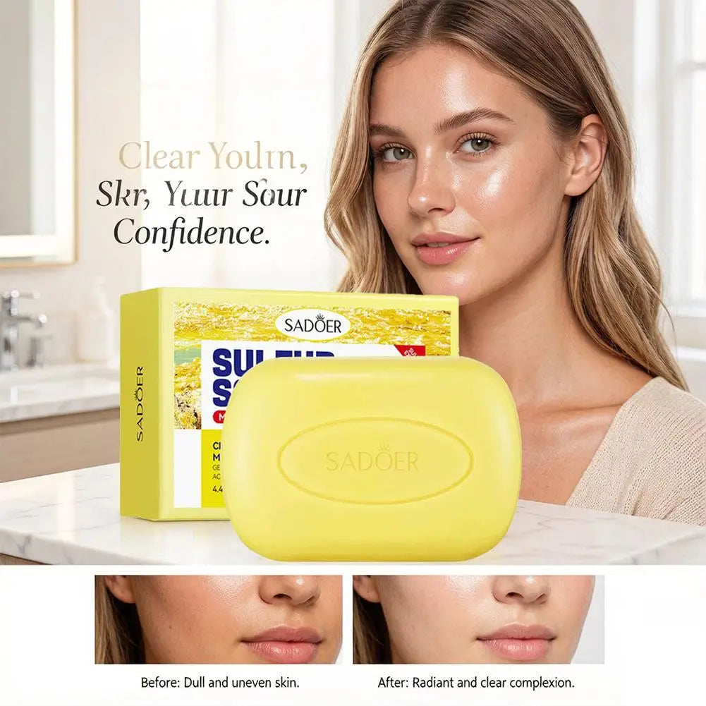Sulfur soap bar formulated to remove mites and moisturize skin