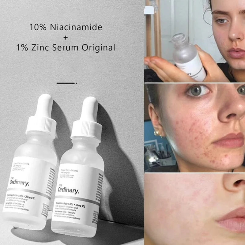 SkinSwaag Beauty The Ordinary Niacinamide 10% + Zinc 1% Serum — niacinamide + zinc — ingredient list on packaging on white background