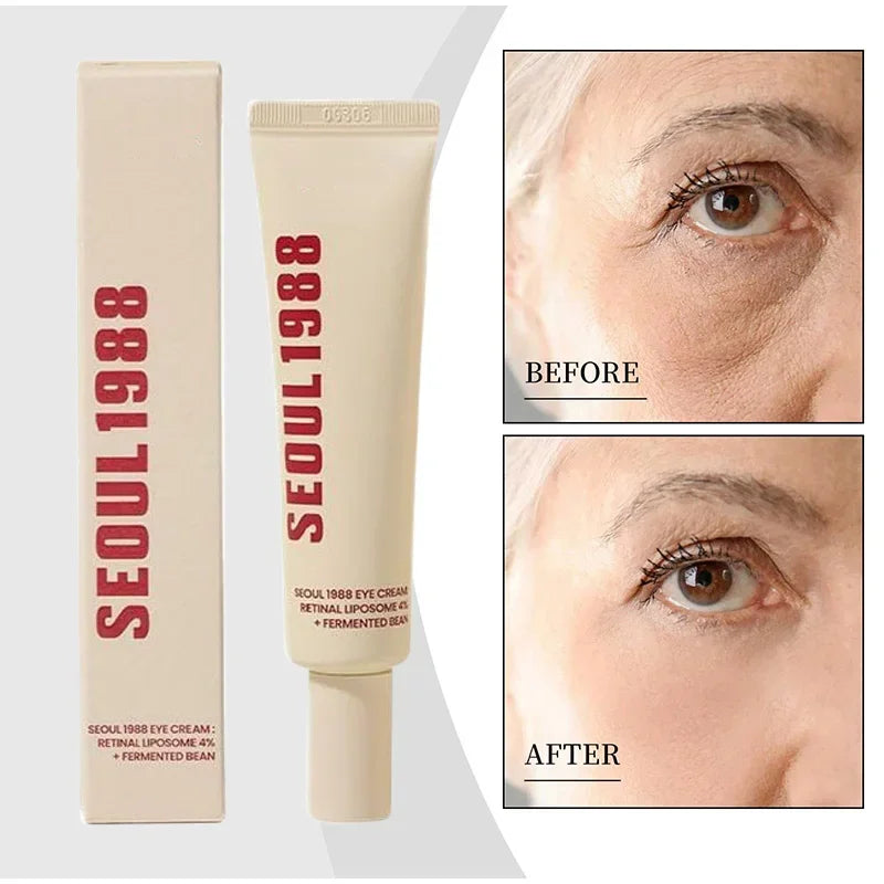 Retinol firming eye cream tube targeting dark circles and puffiness