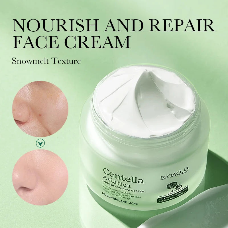 Centella Asiatica acne-soothing face cream product