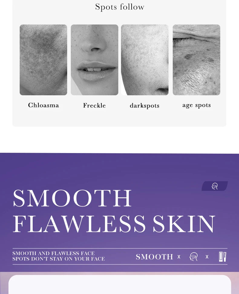 Dark spot freckle brightening cream with niacinamide in a cosmetic jar