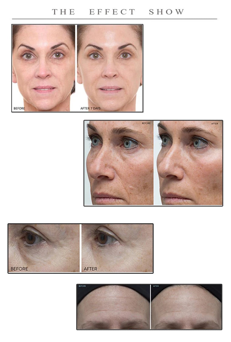 SPA Treatment Snake Venom Eye Mask — snake venom Syn-Ake — before and after results