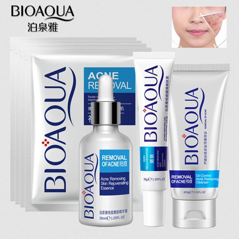 Facial cream jar for acne treatment with salicylic acid, pore-refining formula.
