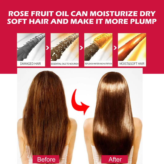 EELHOE — Rosehip Oil Serum — Serum application on face