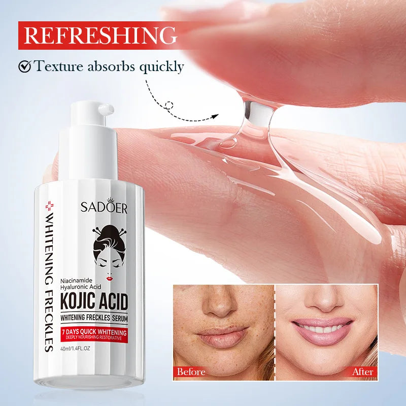 Serum bottle containing kojic acid for brightening and freckle removal