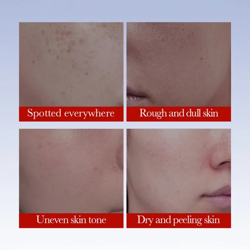 SADOER Niacinamide Dark Spot Correcting Brightening Cream