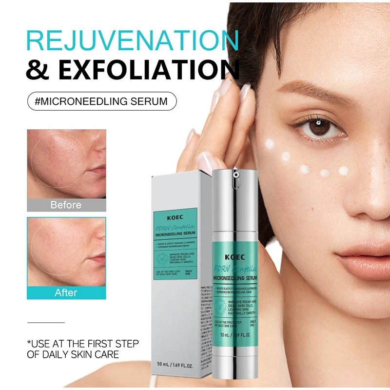 Microneedle serum set with PDRN skincare ampoules for skin rejuvenation