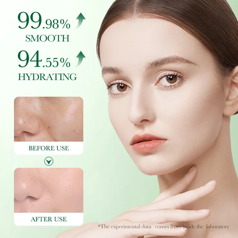 Centella Asiatica acne-soothing face cream product