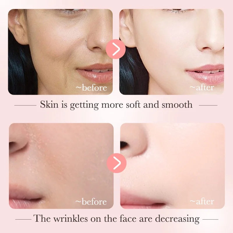 Niacinamide brightening serum bottle for reducing dark spots 30ml