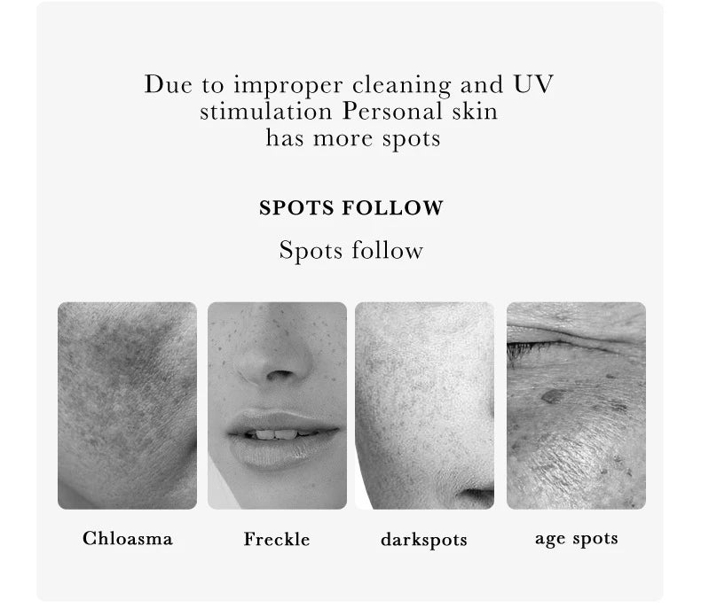 Nicotinamide dark spot correcting essence skincare set