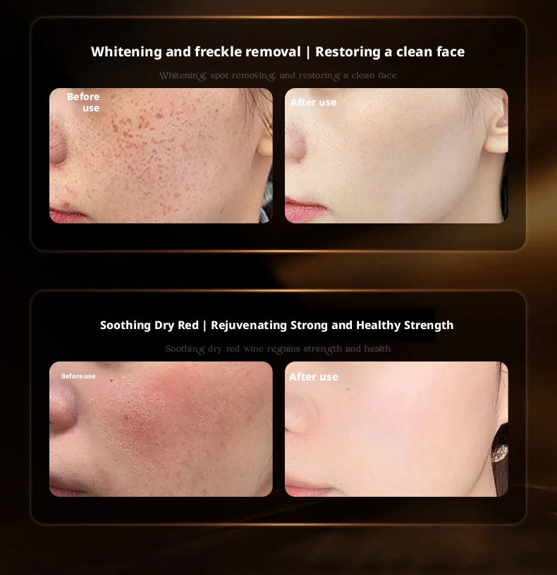 OHBT Black and White Loose Face Cream tightens, anti-wrinkle, reduces fine lines, removes yellowing, hydrates and moisturizes