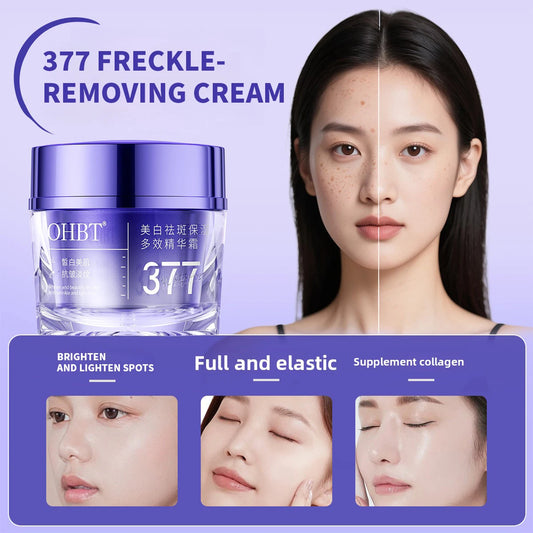 Freckle removing cream jar for lightening spots and moisturizing