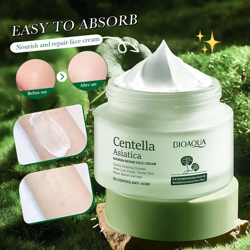 Acne-soothing face cream with centella asiatica