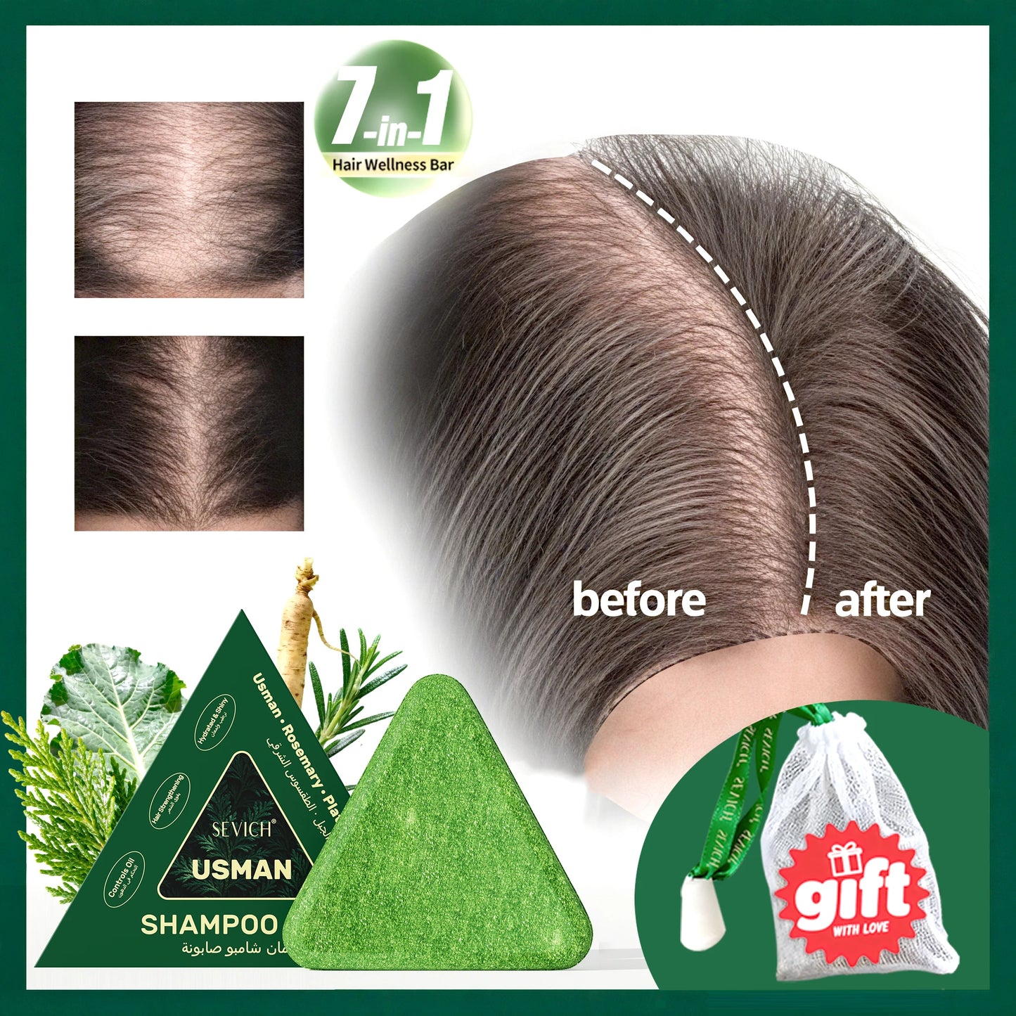 Anti hair loss set with hair growth serum, essential oil, shampoo, soap, and thickening oil spray.